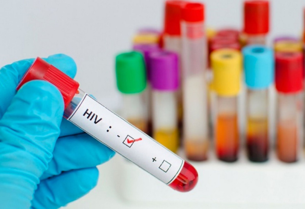 Xét nghiệm các bệnh lây qua đường tình dục (STDs)