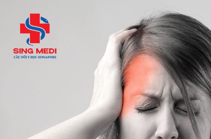 Chứng đau nửa đầu liệu có phải do thay đổi thời tiết?