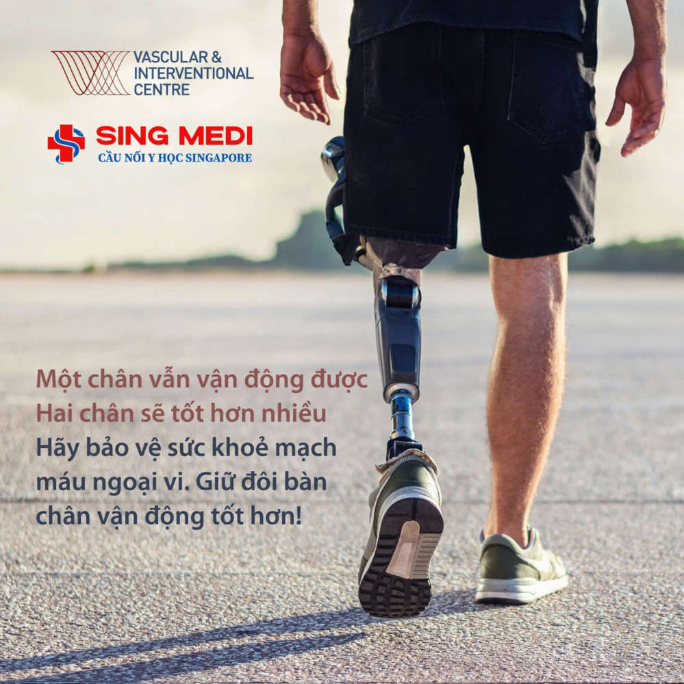 Bạn có đang đối mặt với nguy cơ mắc Bệnh Động Mạch Ngoại Biên (PAD)?