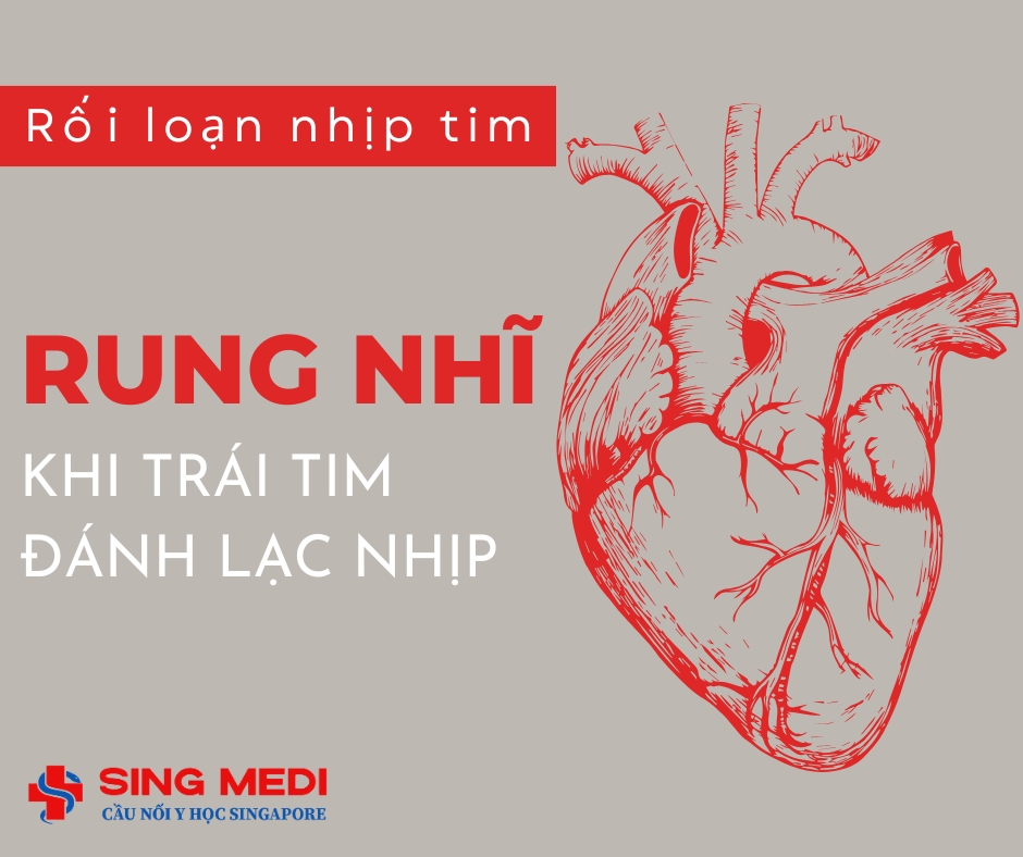 Rối loạn nhịp tim (Rung nhĩ) – Khi trái tim đánh lạc nhịp