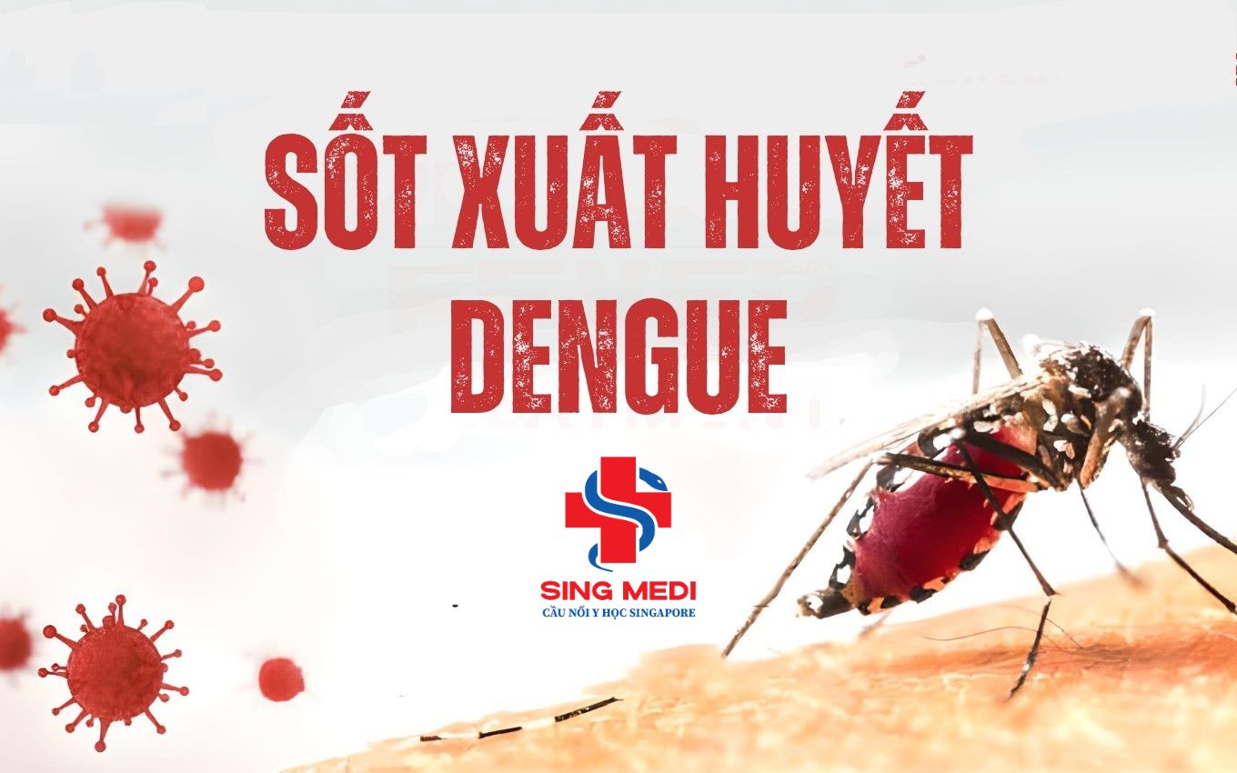 Giải đáp căn bệnh sốt xuất huyết