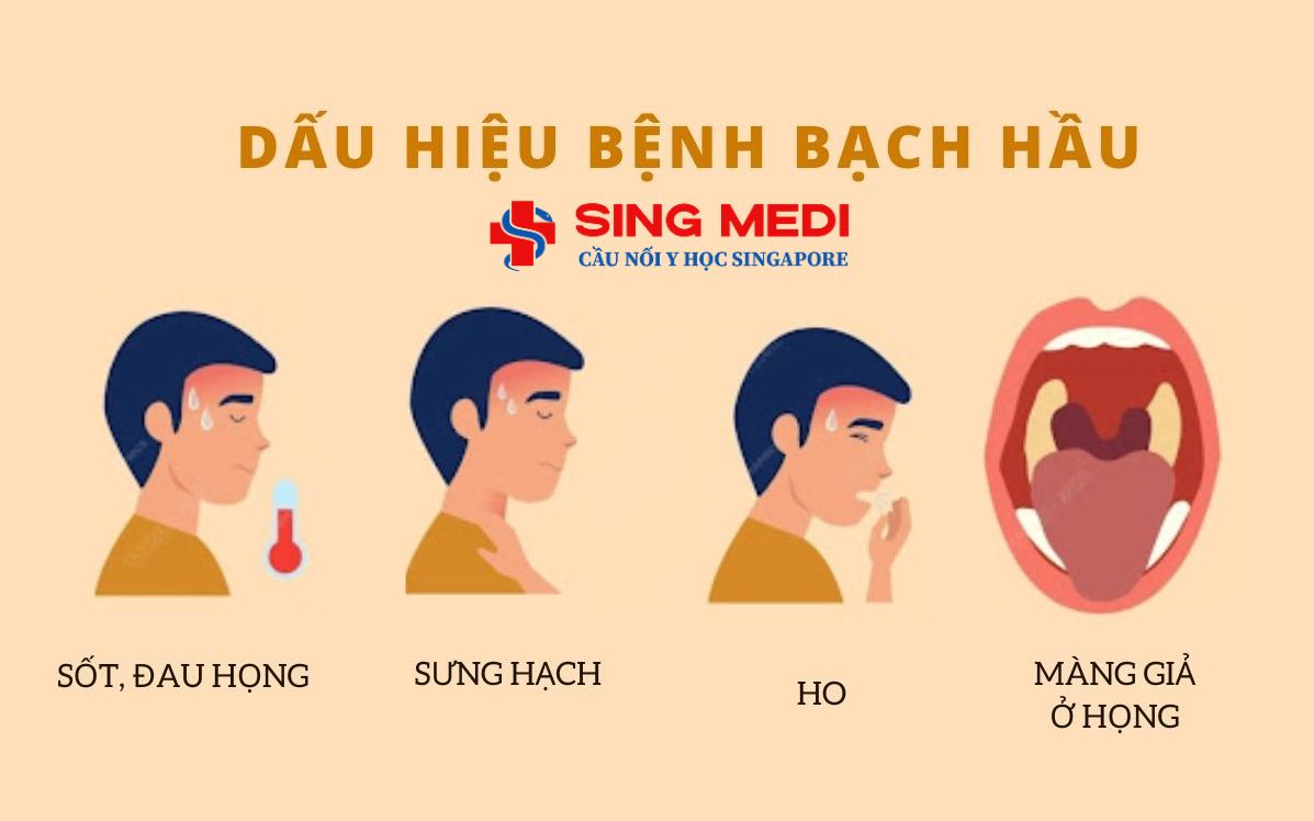 Dấu hiệu bệnh bạch hầu có dễ nhận biết ?
