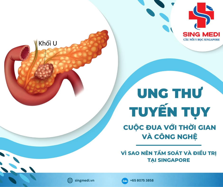 Ung thư tuyến tụy – Cuộc đua với thời gian và công nghệ: Vì sao nên tầm soát và điều trị tại Singapore?