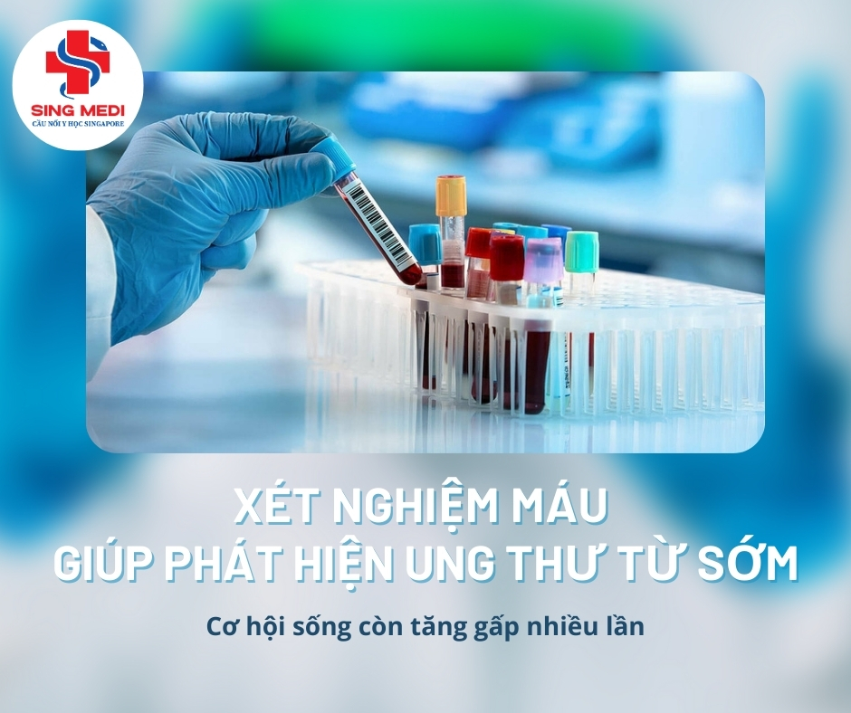 Xét Nghiệm Máu Phát Hiện Ung Thư Từ Sớm – Cơ Hội Sống Còn Tăng Gấp Nhiều Lần