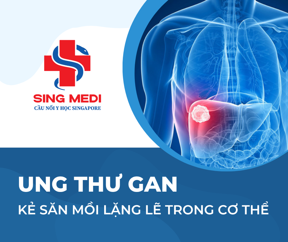 Ung thư gan – Kẻ săn mồi lặng lẽ trong cơ thể