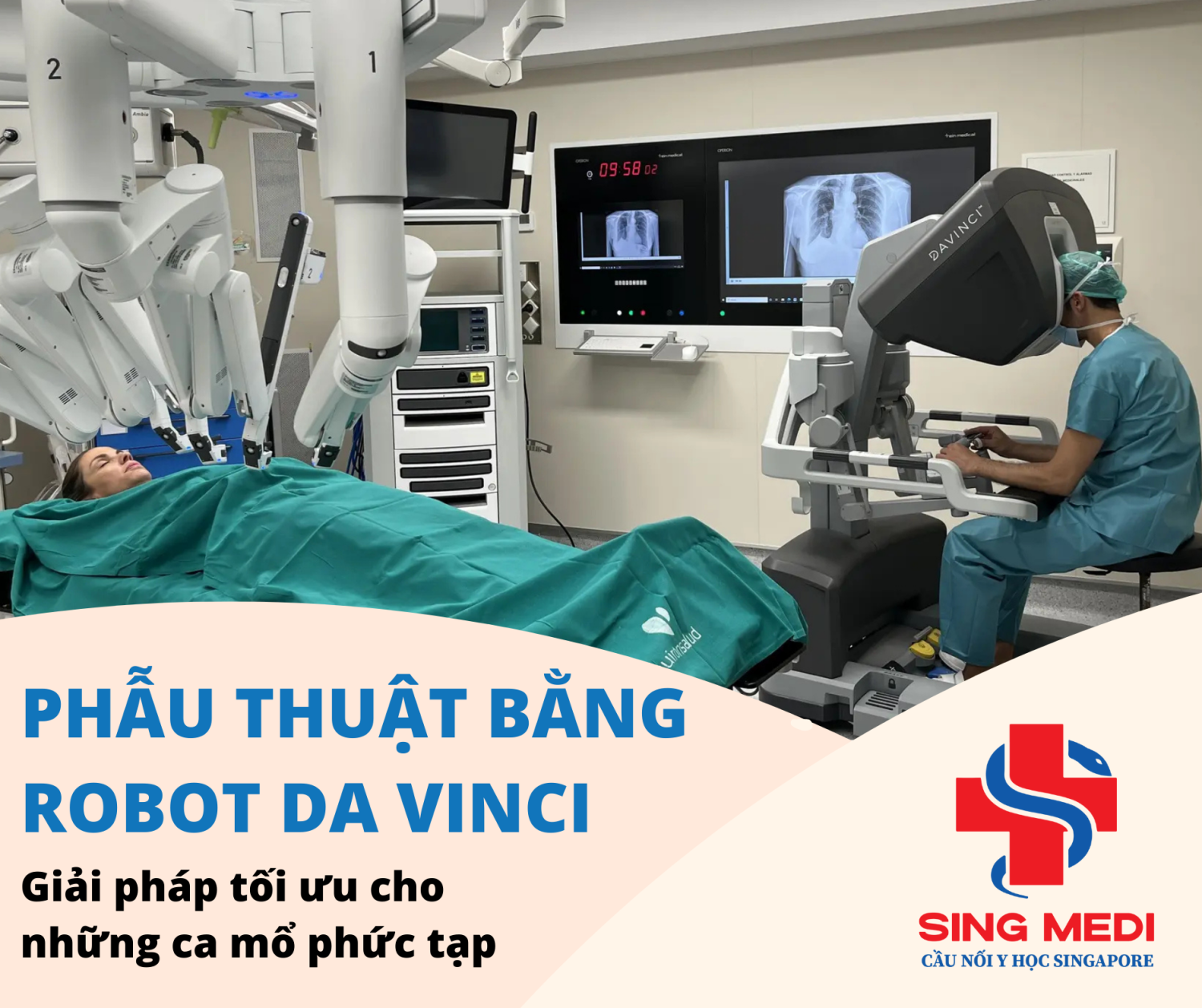 Phẫu thuật Robot Da Vinci – Giải pháp tối ưu cho những ca mổ phức tạp