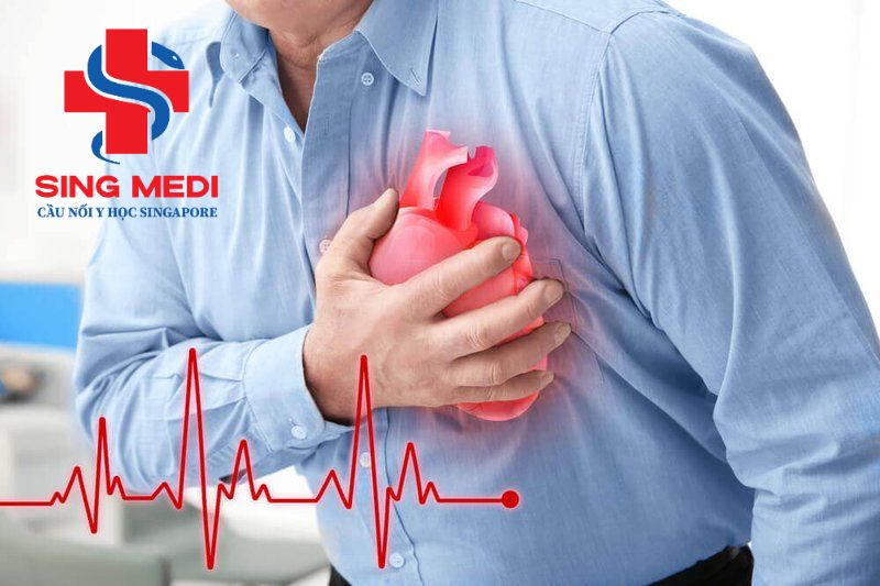Tầm soát sức khoẻ tim mạch